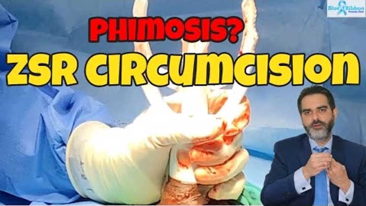 Phimosis: how to treat a tight foreskin in adults